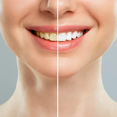 Smile by Dr Noura